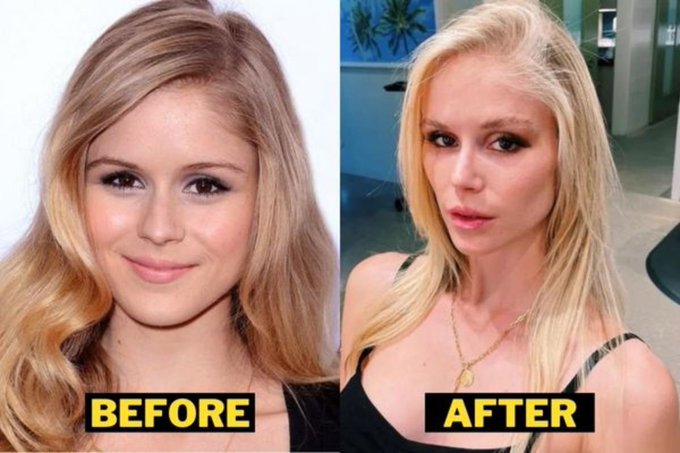 Erin Moriarty Before and After Plastic Surgery