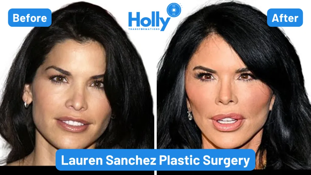 Lauren Sanchez's Plastic Surgery Transformation Before and After Image. In the left her face seems natural and in the right her face seems like she has undergone plastic surgery or some surgical procedures to enhance her looks.