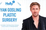 Ryan Gosling Plastic Surgery