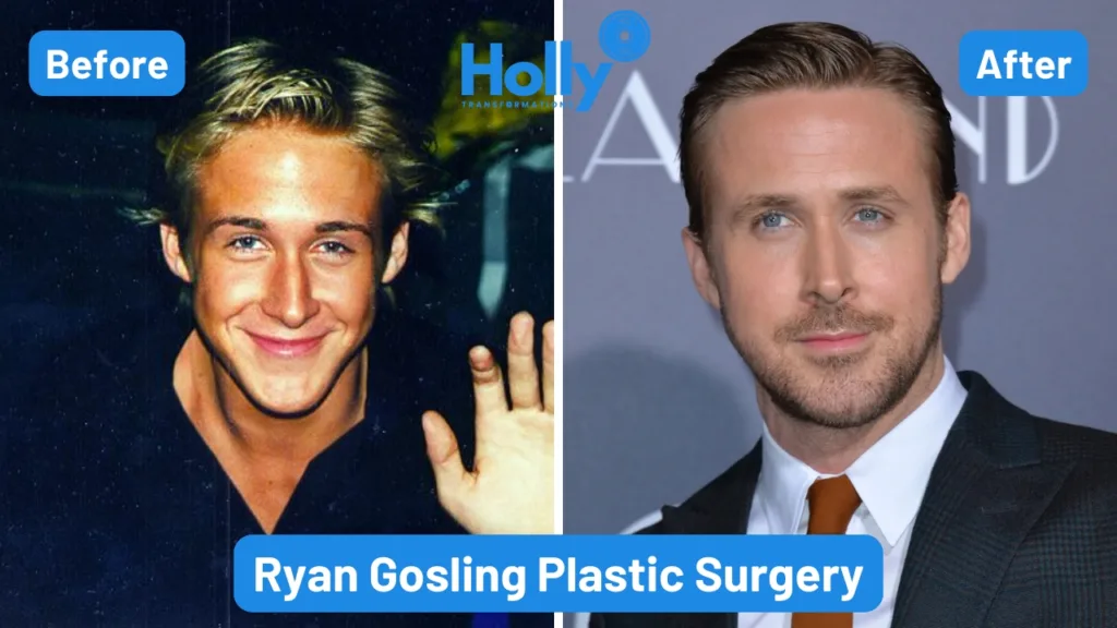 Ryan Gosling Plastic Surgery Transformation Before and After. In the left image Ryan's face, especially his nose and chin could be seen more sharp but in the right image his face seems more smooth and filled.