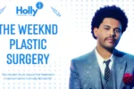 The Weeknd Plastic Surgery