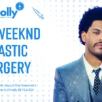 The Weeknd Plastic Surgery