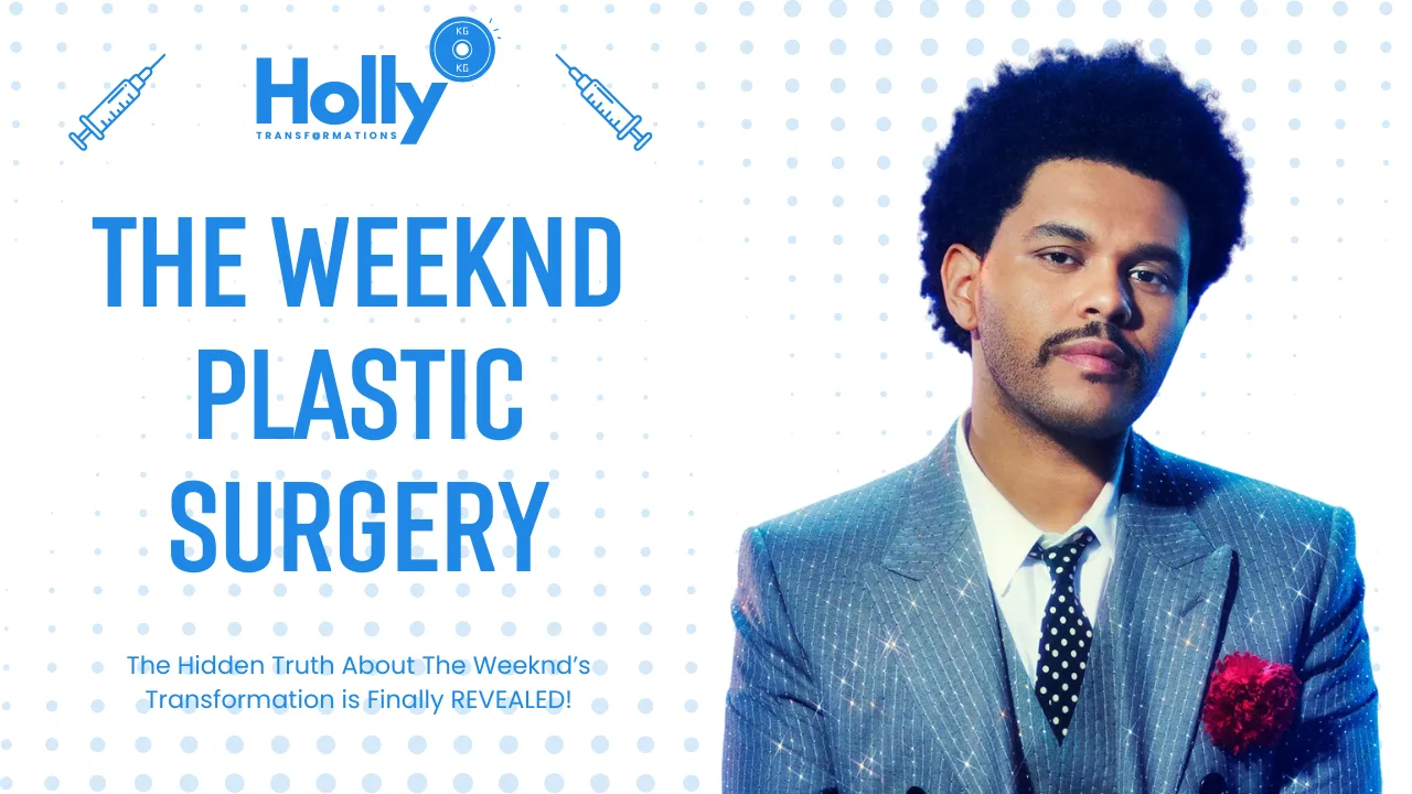 The Weeknd Plastic Surgery