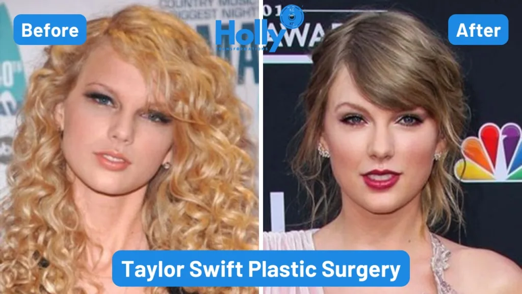 Taylor Swift Plastic Surgery Transformation Before and After. In the left image her lips are small and jawline seems more curved as compared to the right image in which her lips are looking bigger and her jawline is more sharper.