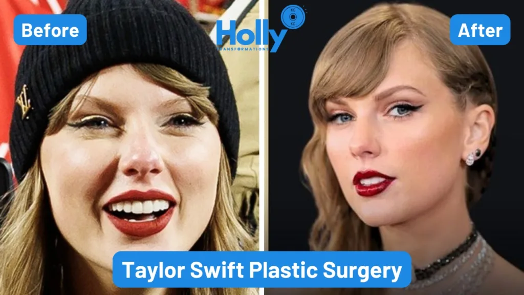 Taylor Swift Plastic Surgery Transformation Before and After. In the left image her face shape is more oval as compared to the right image in which her face is more sharp. Her jawline, her nose and her rose are transformed, giving signs of plastic surgery procedures.